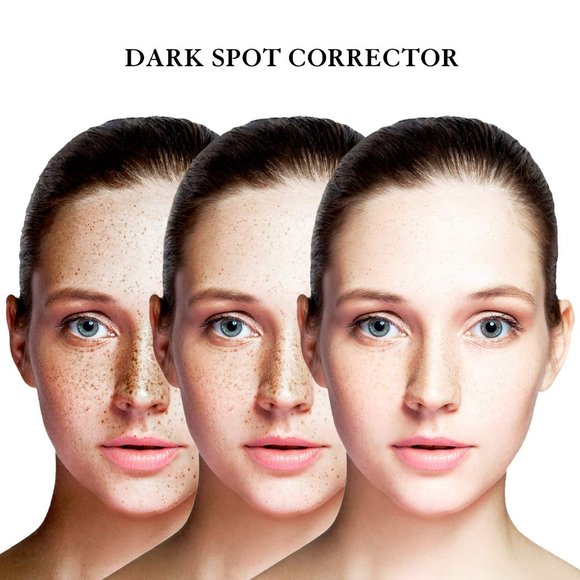 Dark Spot Corrector Serum Removal - Picture 3 of 9